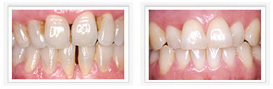 Während Ihres persönlichen Termins gehen unsere spezialisierten Prophylaxe-Assistentinnen auf Ihre individuelle Zahngesundheit ein.